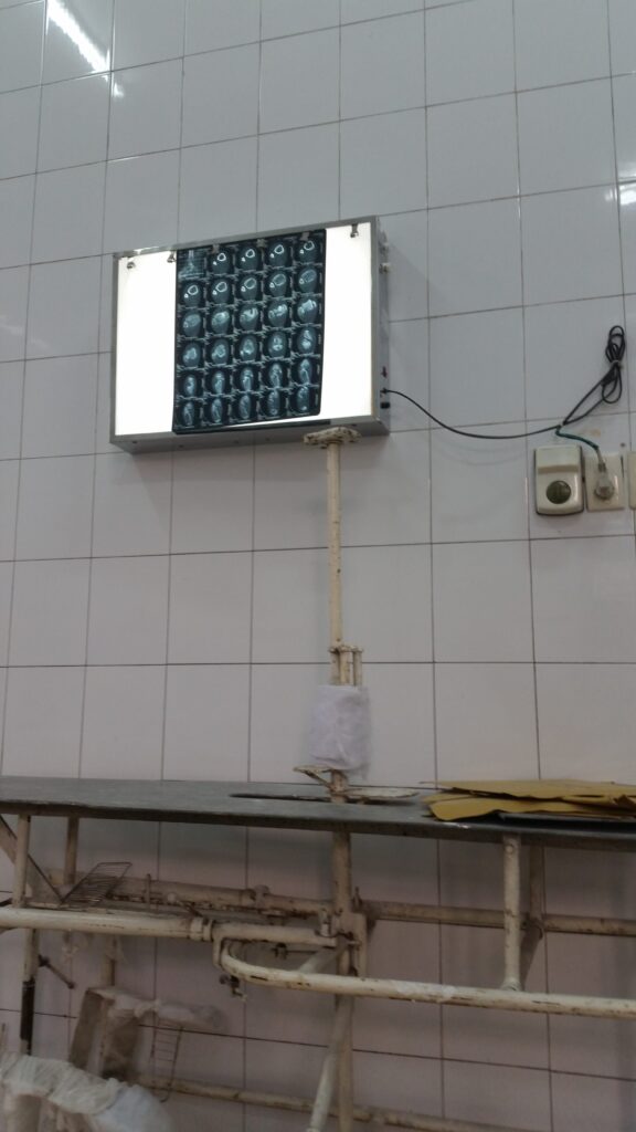 X-ray viewing screen in a Vietnamese hospital with medical equipment and tiled walls